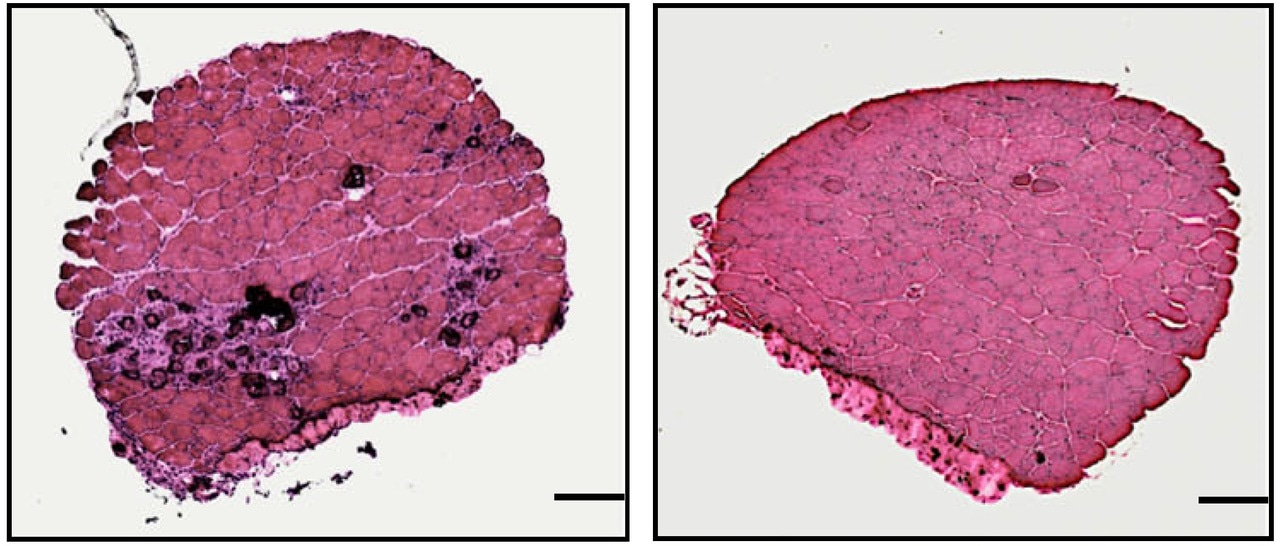 Targeting GSK3 for Duchenne muscular dystrophy