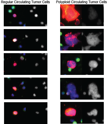 Polyploid cancer cells reveal signatures of chemotherapy resistance 