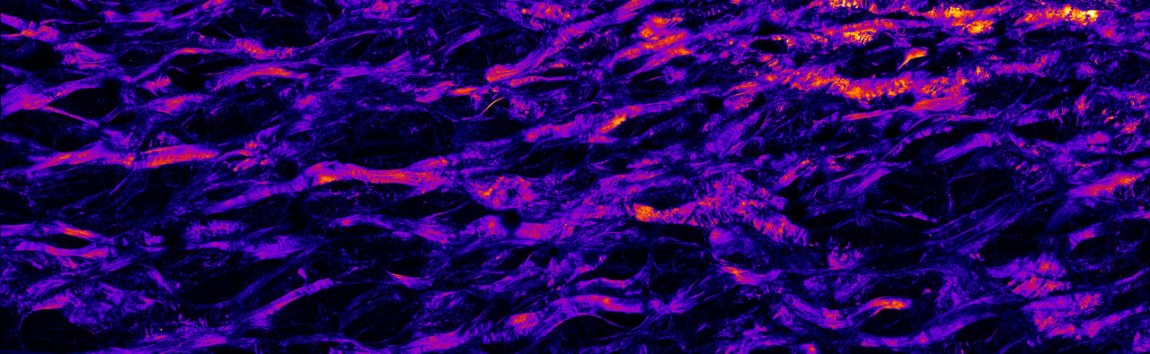 Entangled Elephant Skin Allows Strength and Flexibility