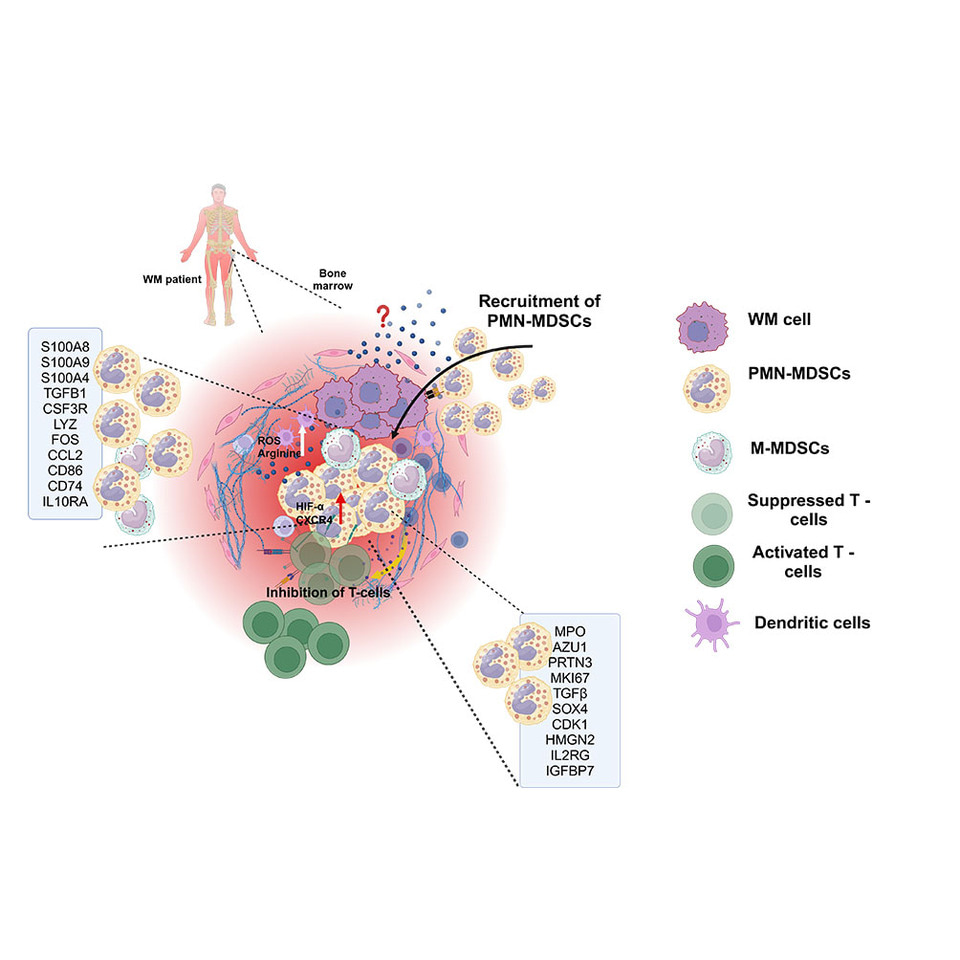 Shielding the Tumor: PMN-MDSCs as Key Drivers of Immune Suppression in Waldenstrom Macroglobulinemia