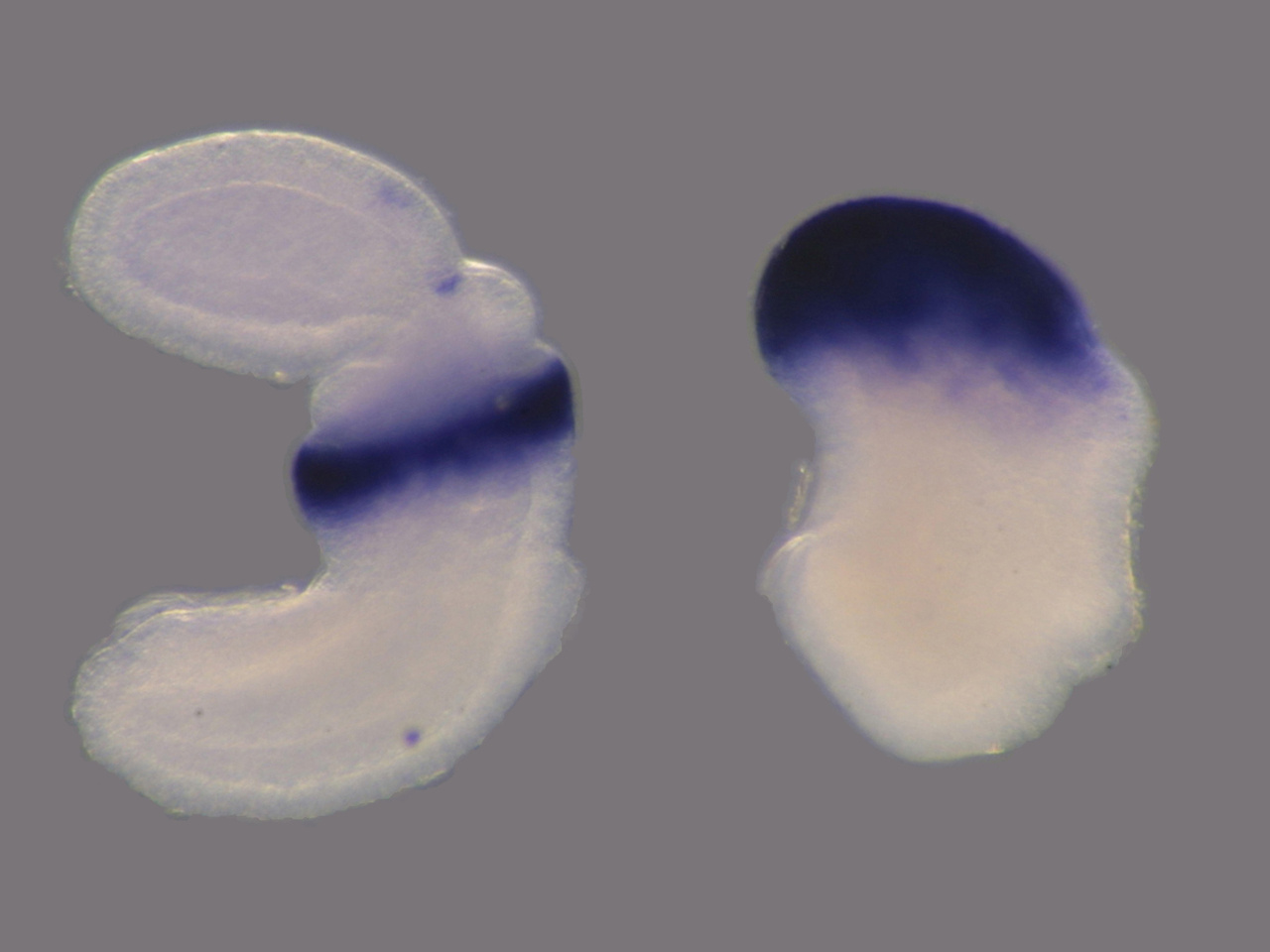 Embryonic axis and acorn worm