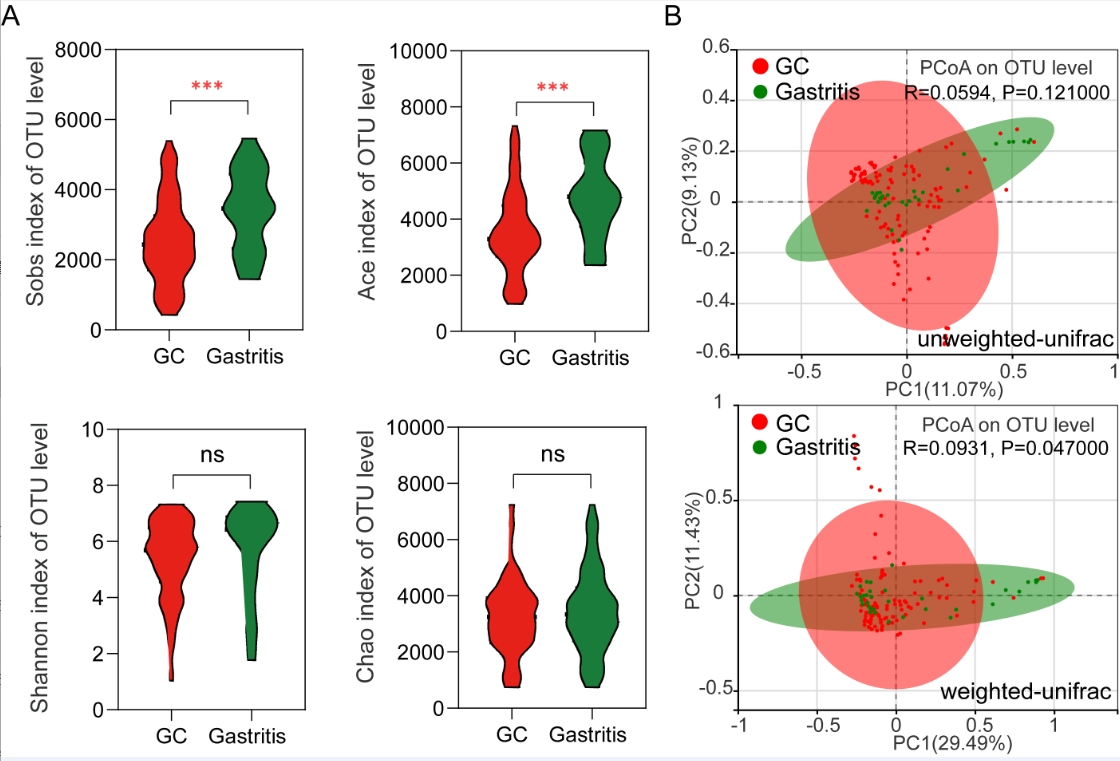The role of streptococcus lutetiensis in gastric cancer