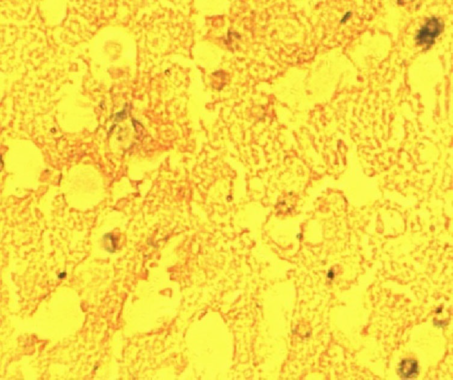 Carvacrol modulates instability of xenobiotic metabolizing enzymes and downregulates the expressions of PCNA, MMP-2, and MMP-9 during diethylnitrosamine-induced hepatocarcinogenesis in rats