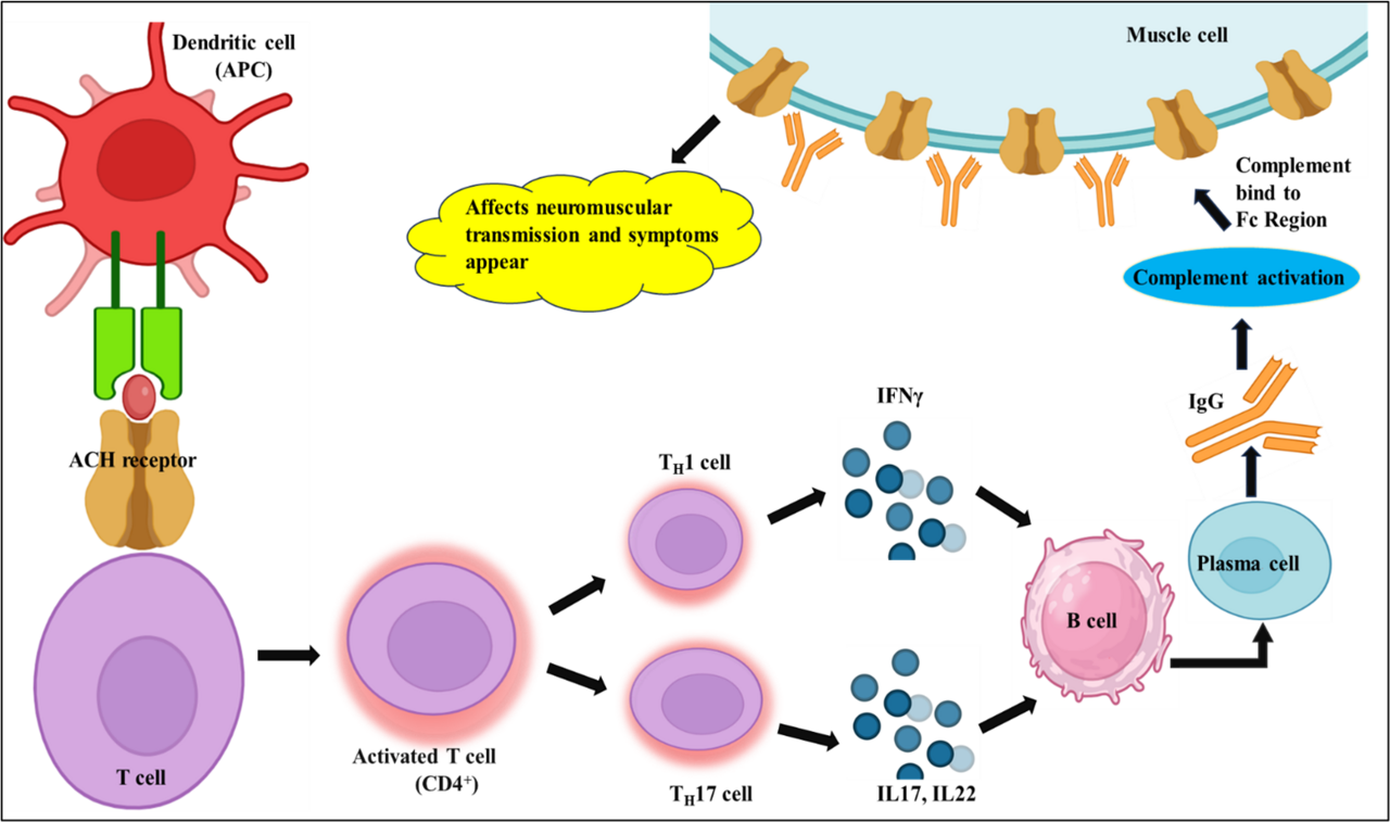 The Impact of Epstein-Barr Virus on Autoimmune Neuromuscular Disorders: A Comparative Study of Myasthenia Gravis and Guillain–Barre Syndrome