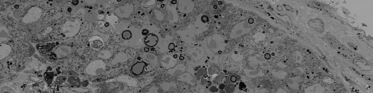 New imaging pipeline developed to decipher cell-specific metabolic functions