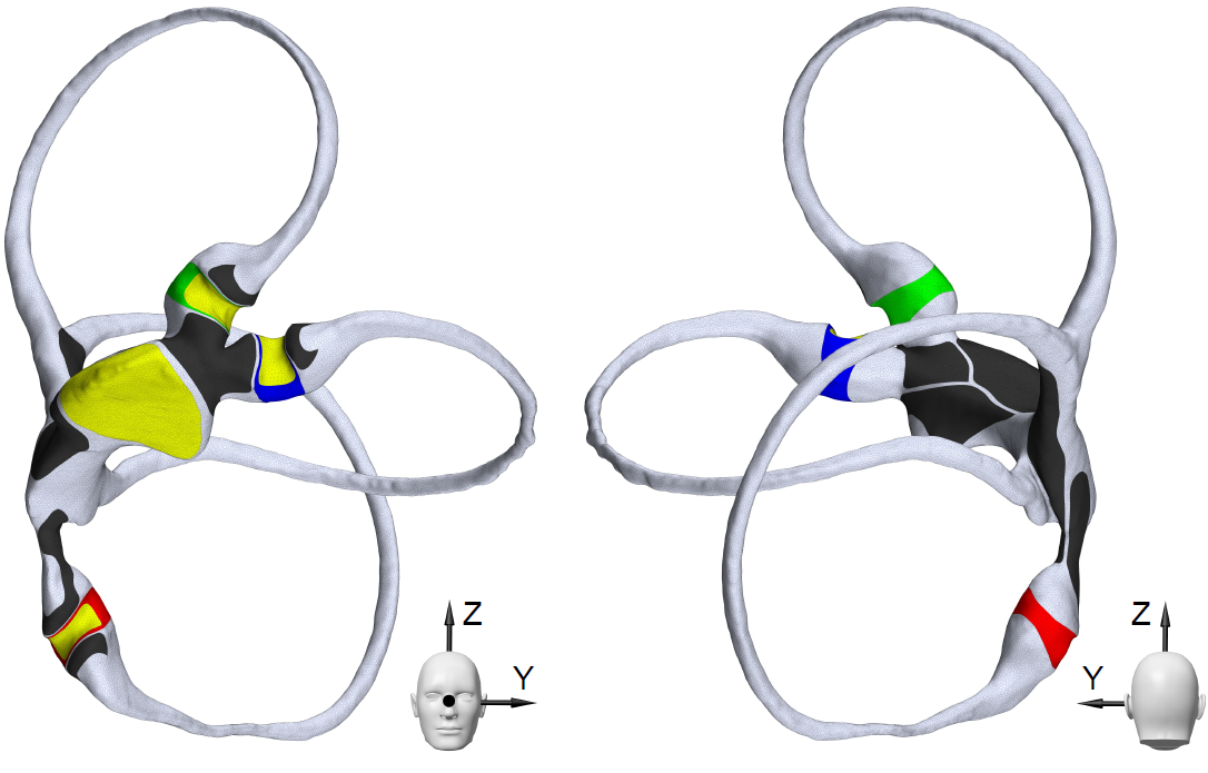 Unraveling MRI-Induced Dizziness: The Physics Behind the Sensation