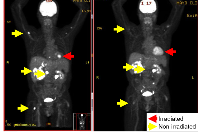 A ReCIPE to Rescue Immunotherapy in Cancer