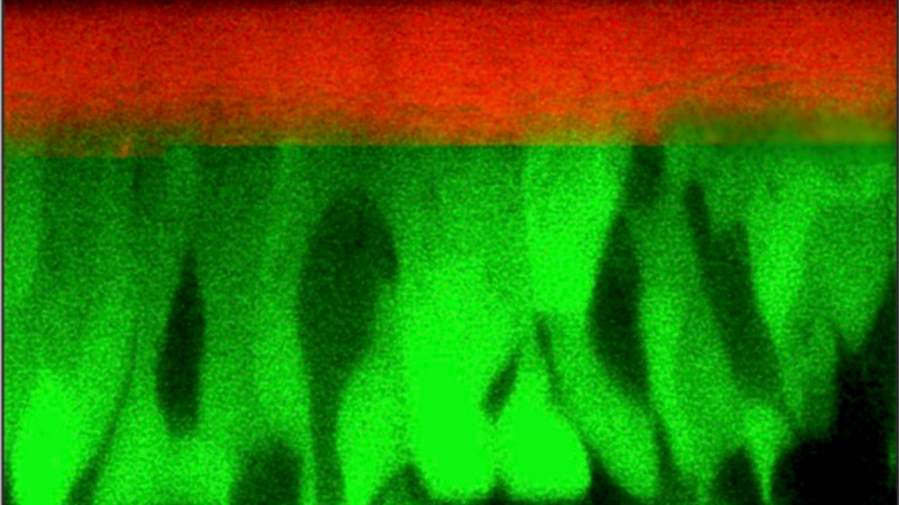 Mucosa exposed to a warming atmosphere share risks faced by planetary vegetation  