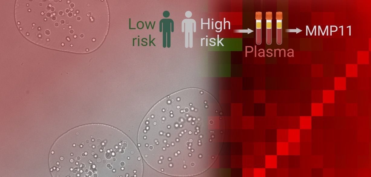 Advancing prostate cancer research with blood-based biomarkers