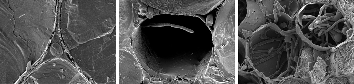Beer, sex and antifungal drugs