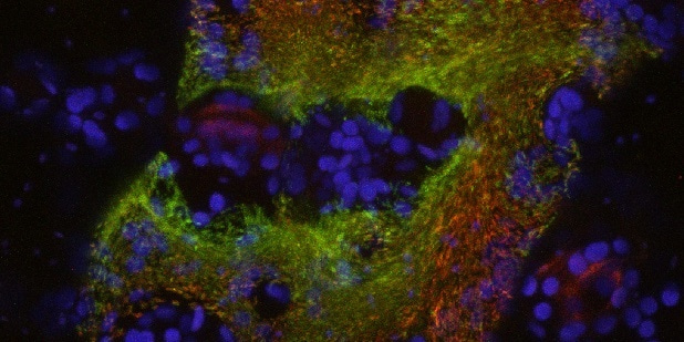 Cooperation in Pseudomonas syringae: How Subpopulations Divide Labor to Infect Plants
