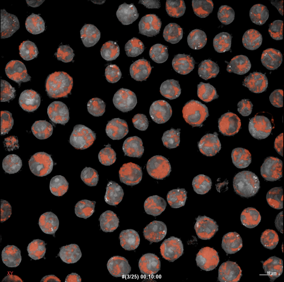 Reprogramming Mitochondrial Metabolism to Overcome AML Drug Resistance: TMQ0153 as a Promising Therapeutic Candidate
