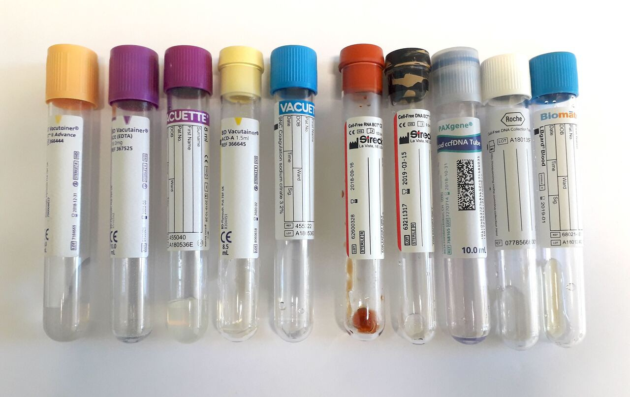 The road to discovery - a collaborative effort towards new insights in blood plasma RNA profiling