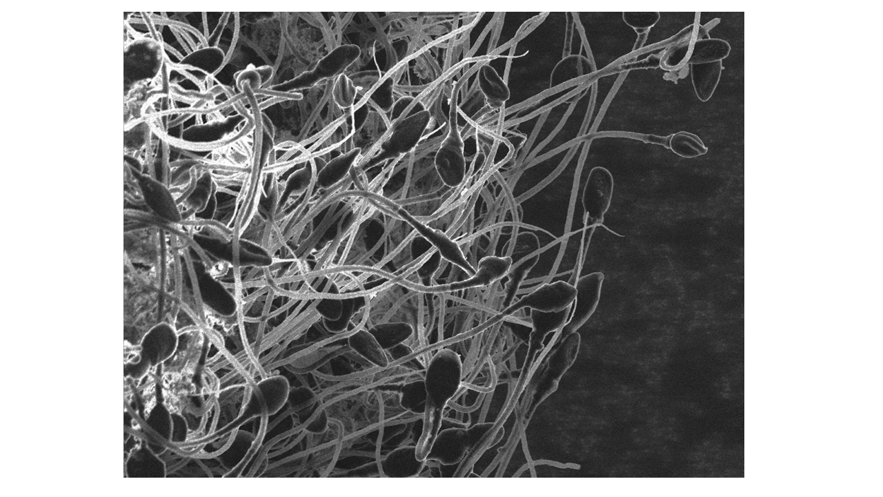 Sperm on the Thermostat: How Heat Controls Male Fertility