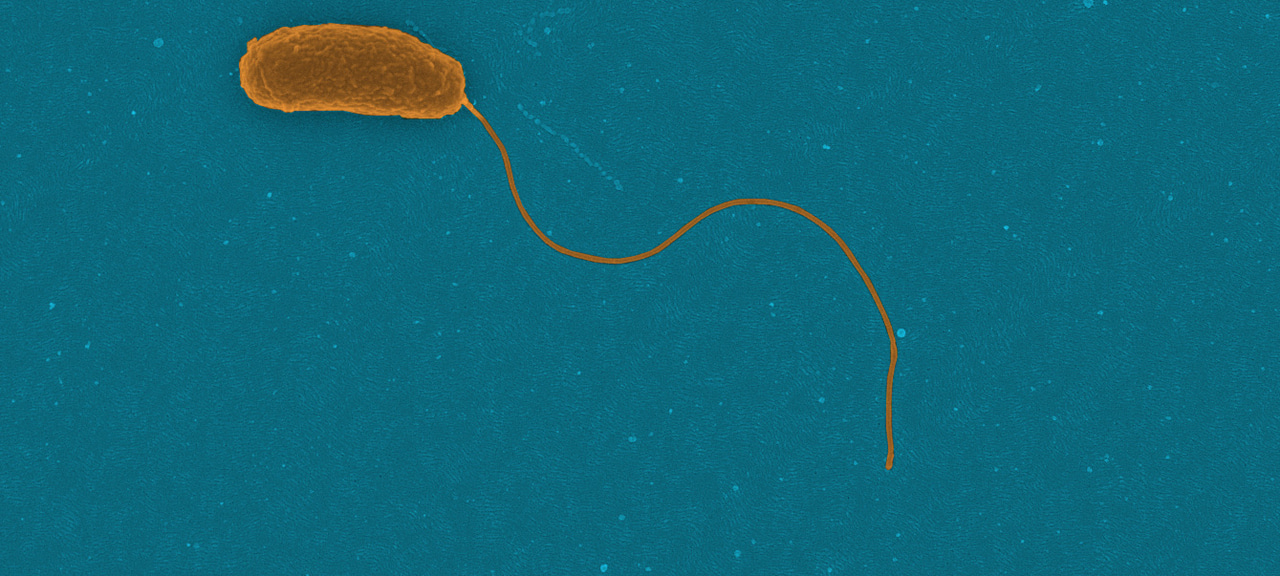 To swim or not to swim during starvation