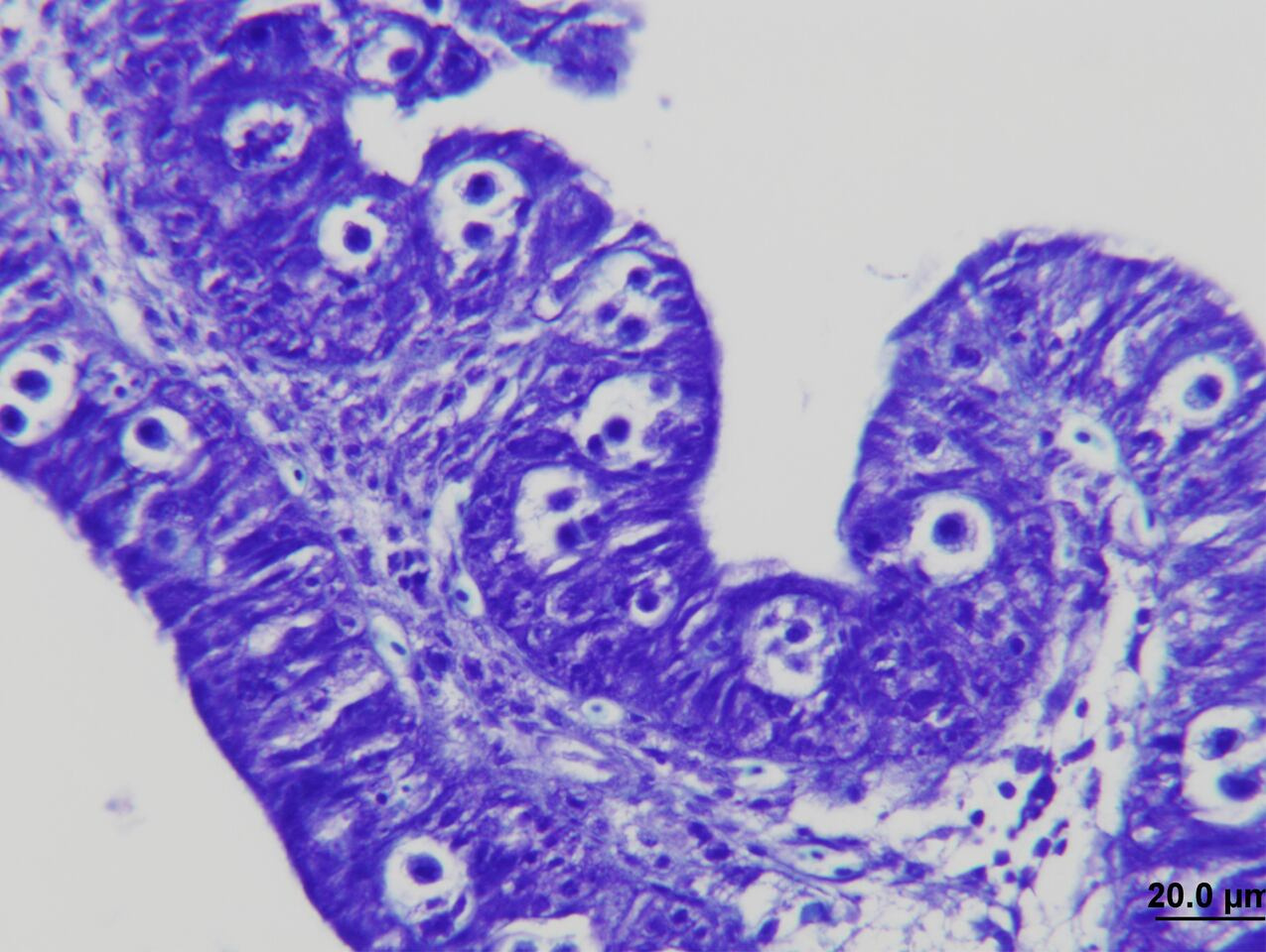 Understanding the impact of Enteromyxum leei on gilthead seabream and its microbiota