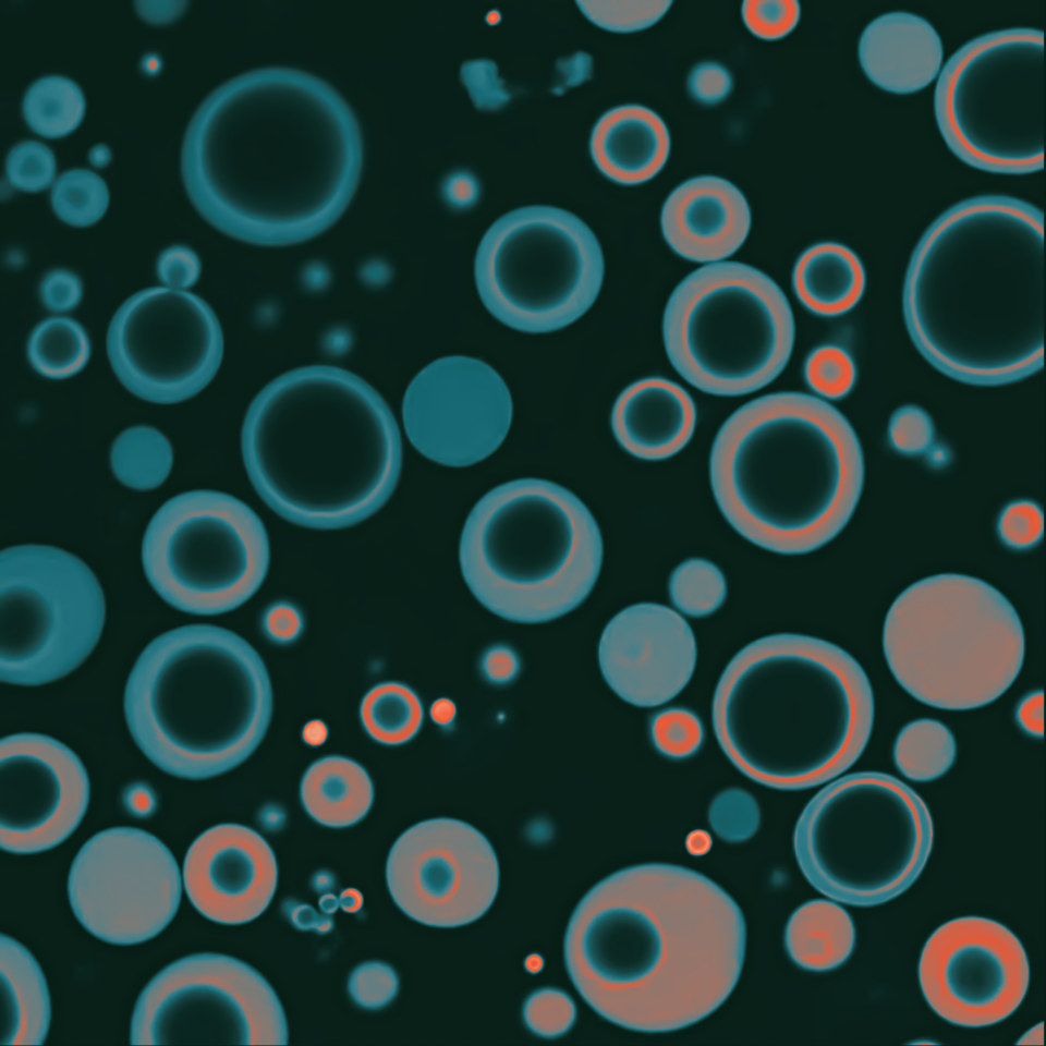 Anomalous diffusion in biomolecular condensates