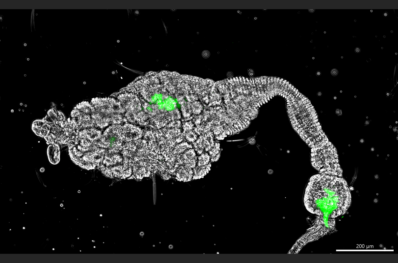 Using bacteria to make sand flies refractory to Leishmania infection