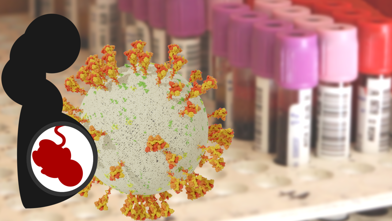 SARS-Cov-2 infection in newborns: cord blood IgA/IgM suggest in utero infection is more common than previously thought