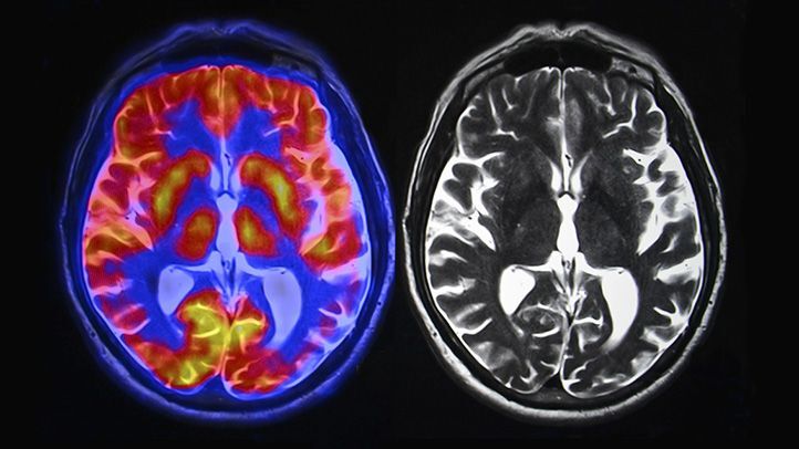 Evaluating Current Methods for Enhancing Clinical Computer Tomography (CT) Imaging Using Contrast Agents