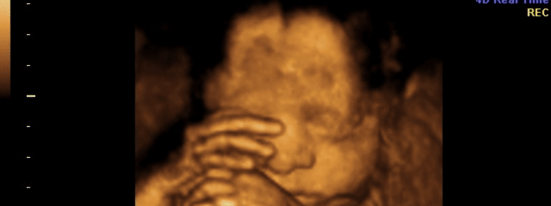 Project Outline: Investigation into the effect of cigarette and e-cigarette exposure on prenatal facial movement with comparison to no exposure.