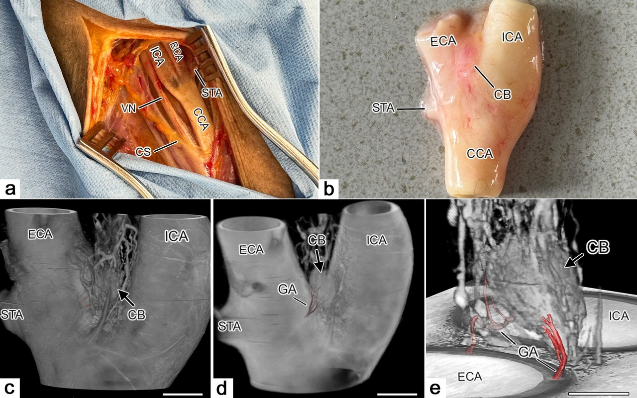 Blood supply of the human carotid  body