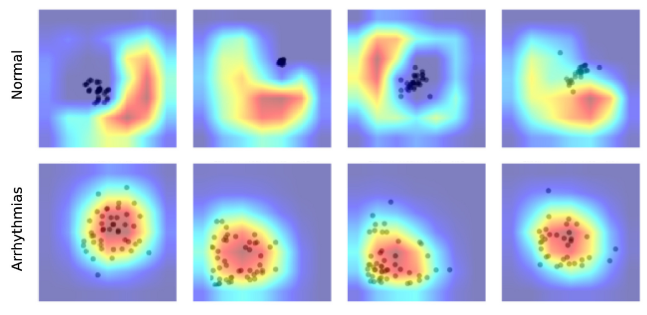 Detecting Heart Disease Smarter: Trade-offs in Accuracy, Speed, and Energy Use