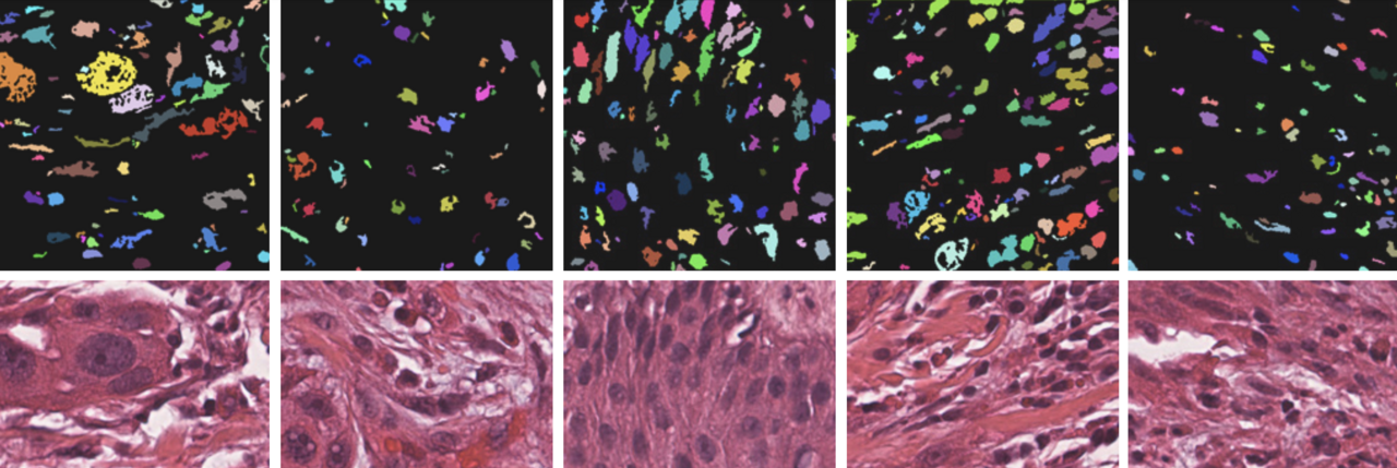 Beyond the Black Box: Interpretable Links Between Morphology and Omics