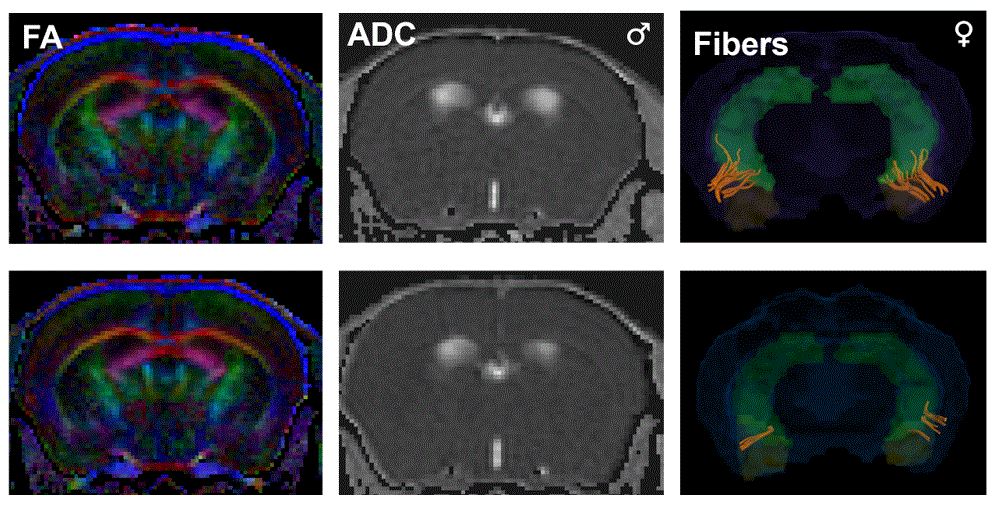 Understanding How Sex-Specific Brain Networks Influence Social Deficits in Autism