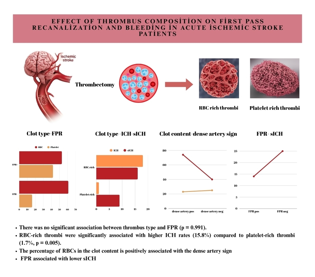 Effect of thrombus composition on first pass recanalization and bleeding in acute ischemic stroke patients