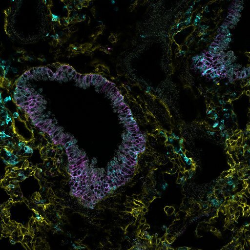 Lung structural cells are altered by influenza virus leading to rapid immune protection following re-challenge