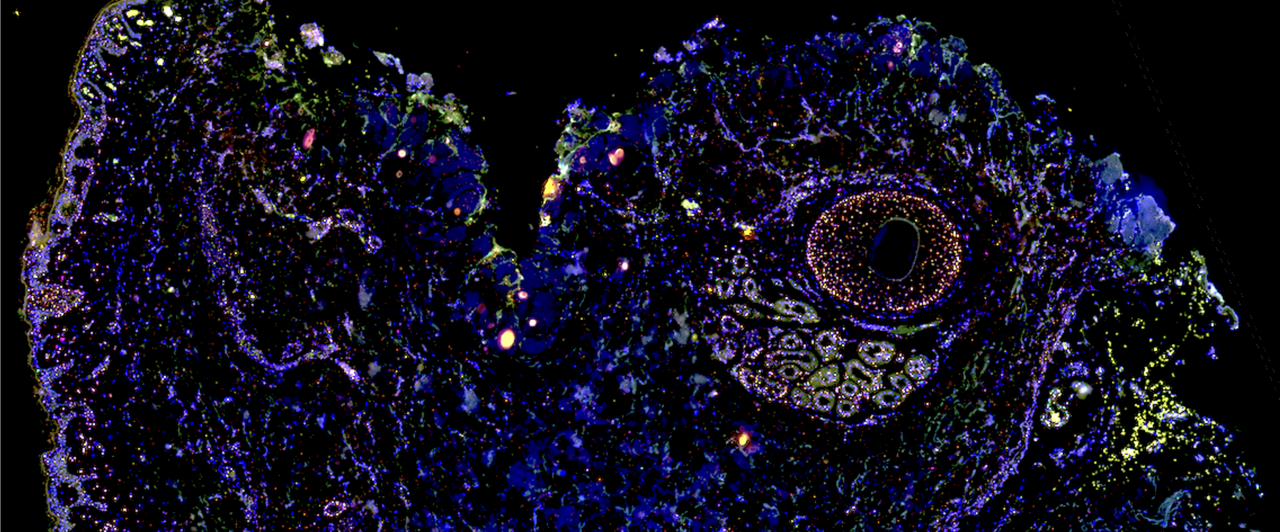 Longitudinal human epidermal and dermal transcriptomic and spatial gene profiling at the incisional edge during long surgical procedures