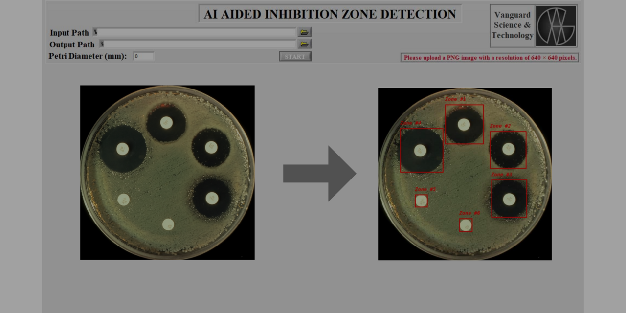 Automating Inhibition Zone Detection with YOLOv8n and LabVIEW Integration