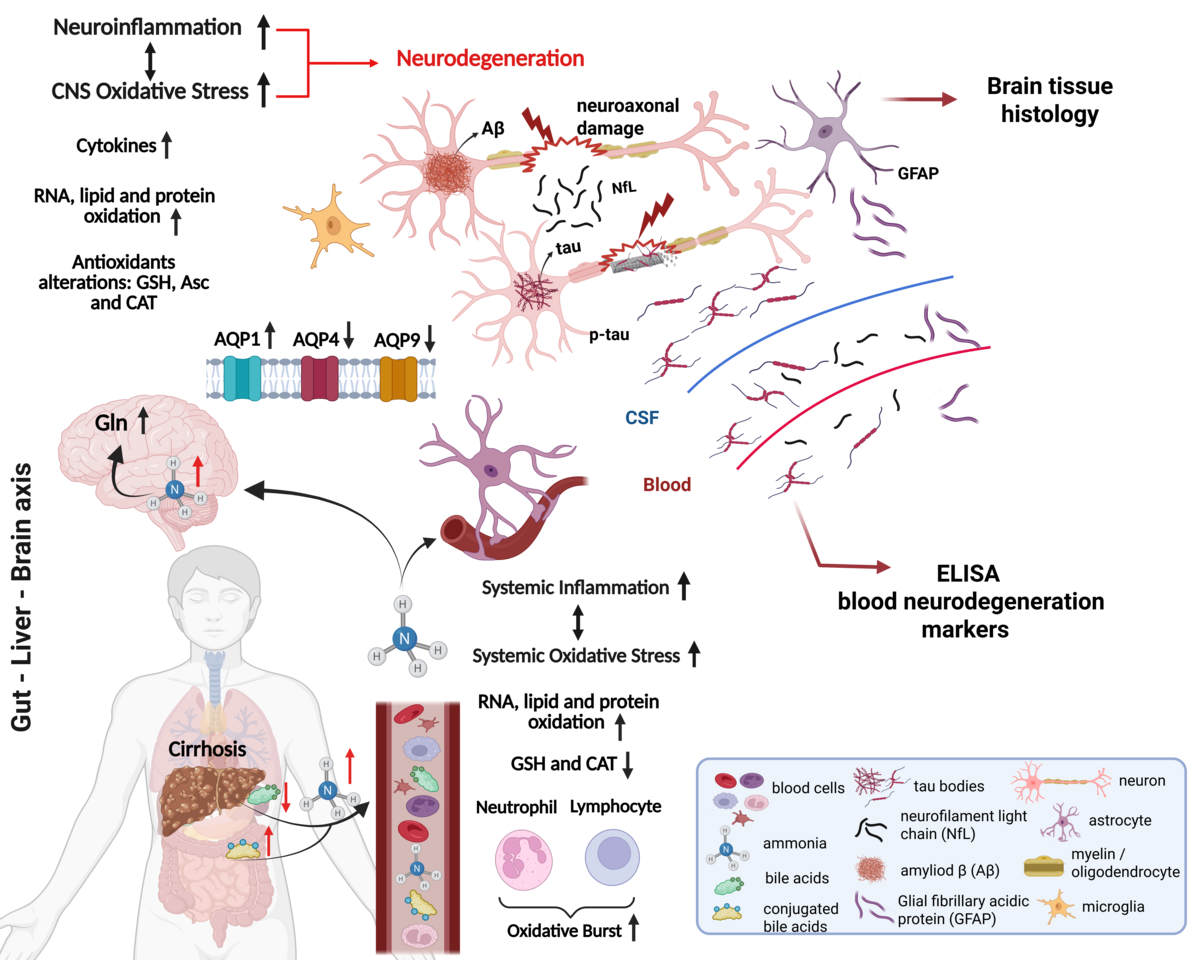 Liver dysfunction triggers early Alzheimer’s pathology in an adult rat model of chronic liver disease