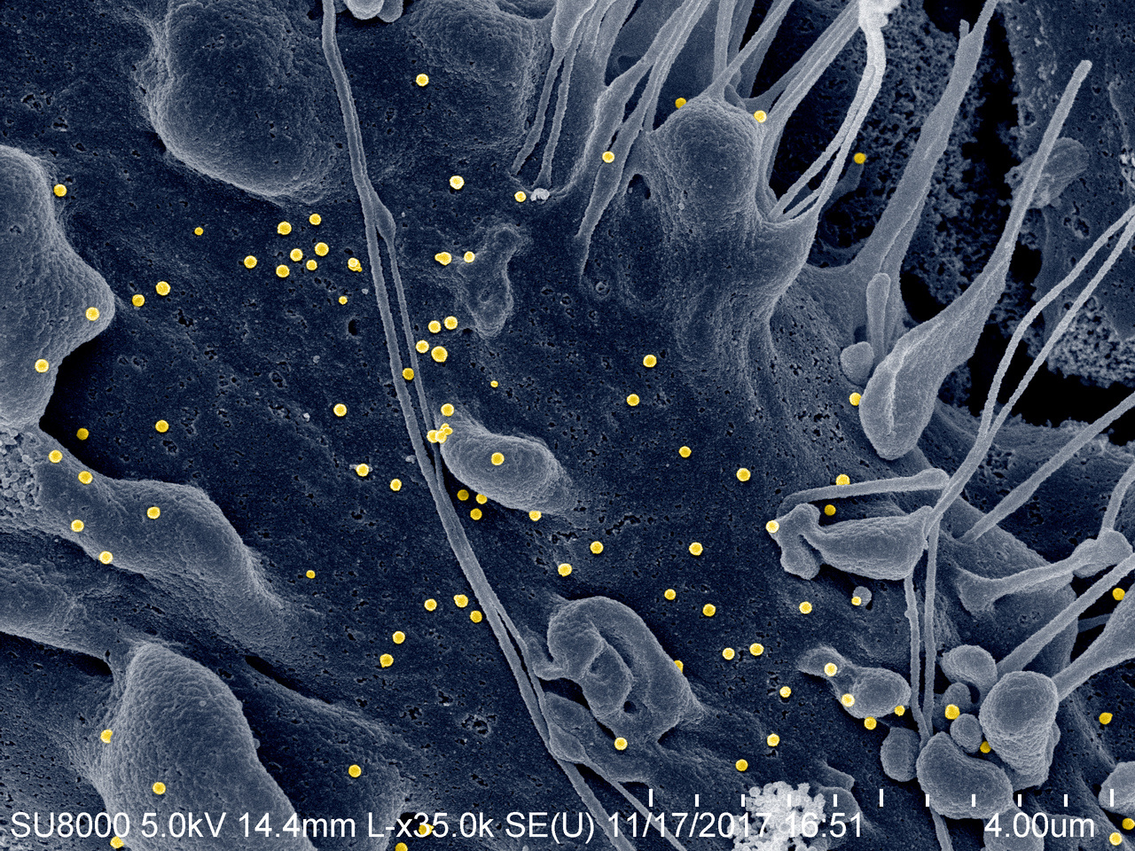 A novel model for Crimean-Congo hemorrhagic fever virus