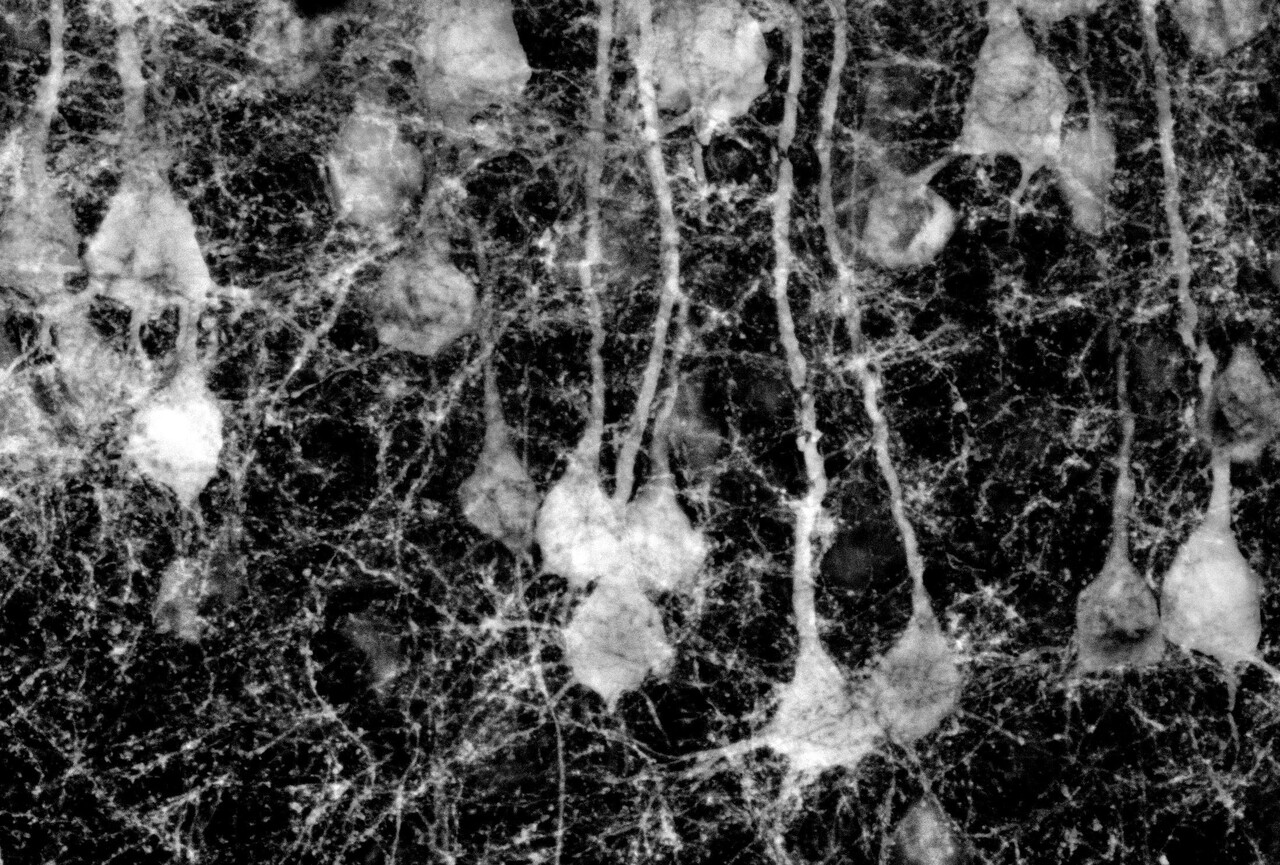 The social little brain: Understanding the role of the cerebellum in social disorders