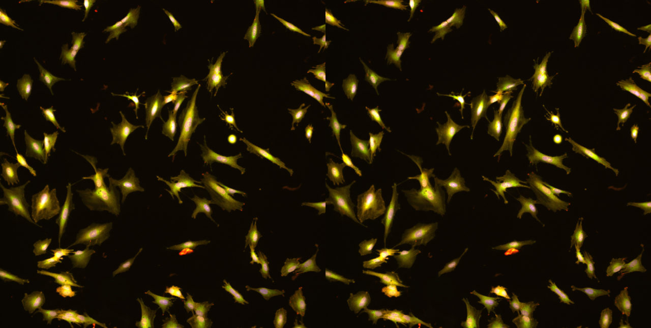 When cells change shape: how organelle dynamics led us to a new way of scoring EMT 