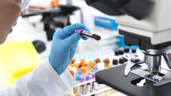 Scientist preparing to view a blood sample under a microscope in laboratory for medical testing.