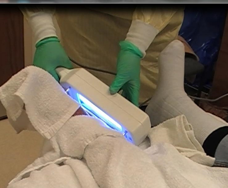 Adjunct therapies Ultraviolet C AccessMedicine Network