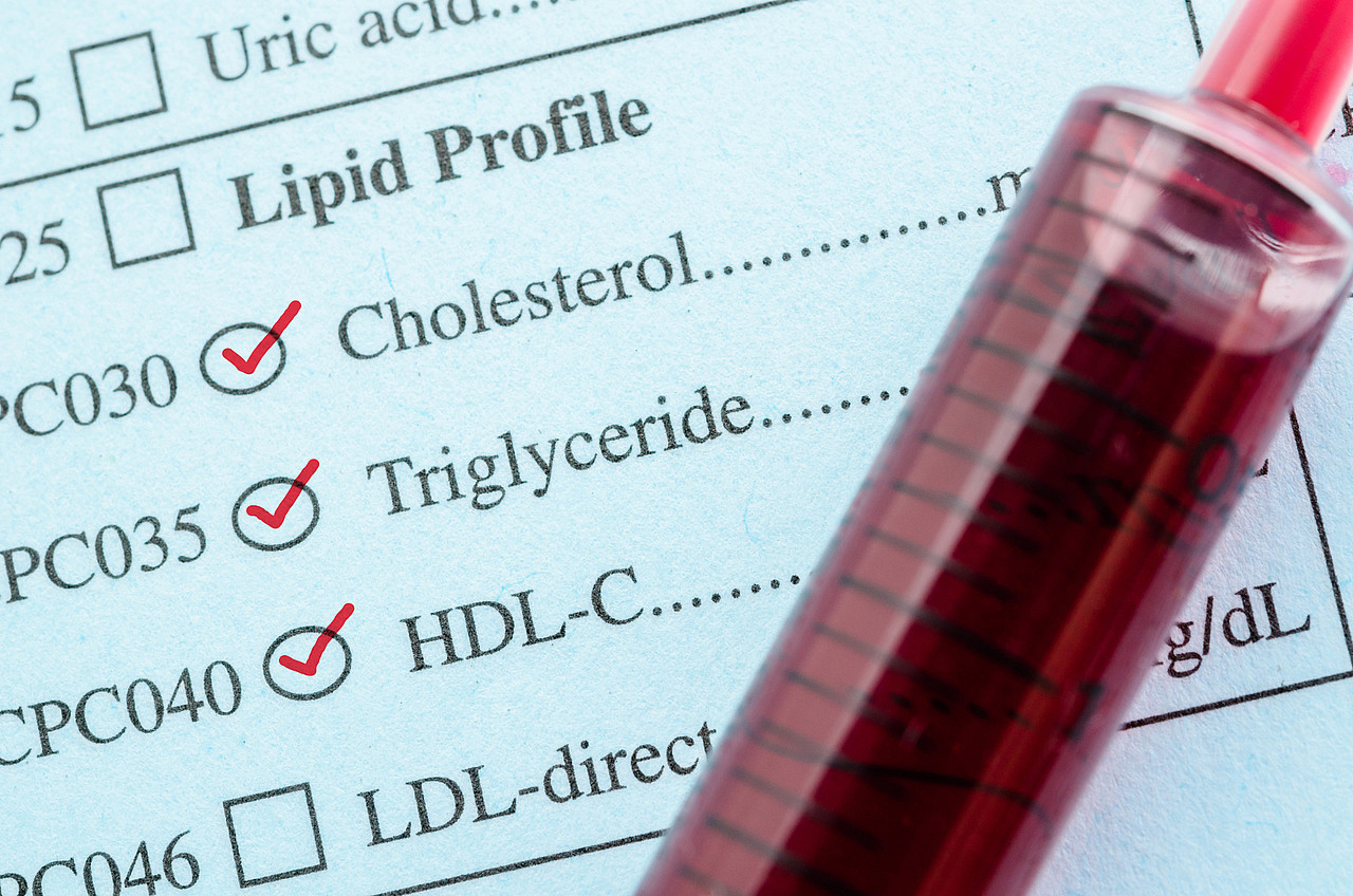 Fall in total and LDL cholesterol follows new US guideline OnMedica