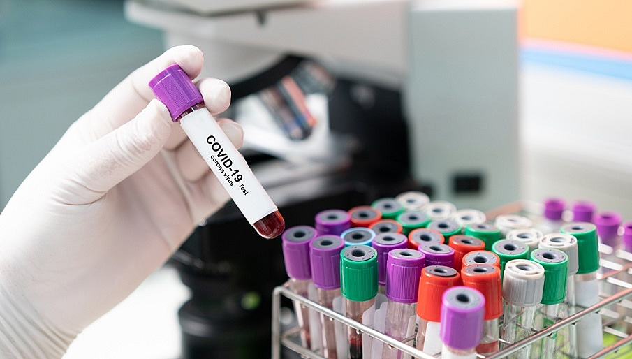 MHRA Results from laboratorybased tests for COVID19 antibodies using