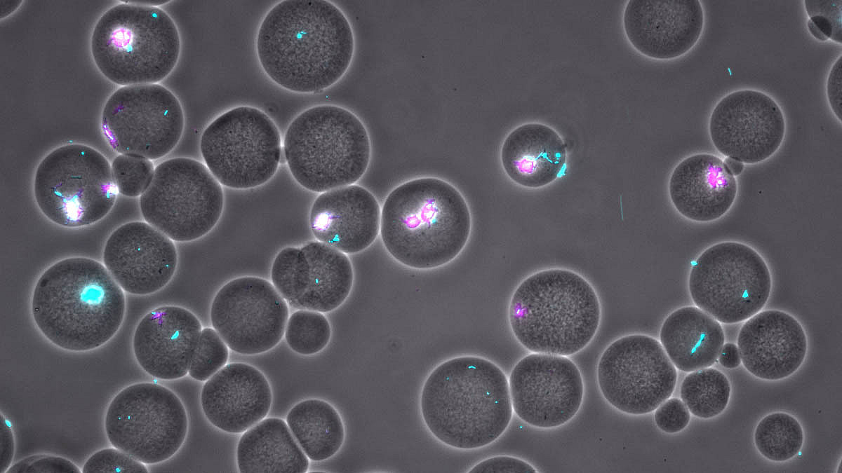 To bead or not to bead Nature Portfolio Microbiology Community