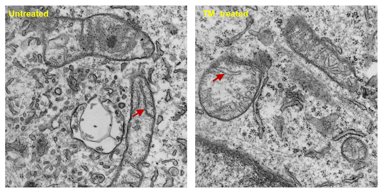 Is Copper a viable target in Breast Cancer metastasis? Nature