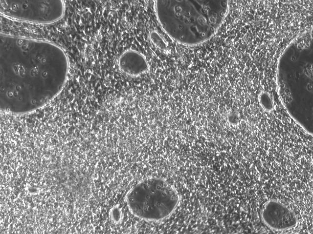 Human cardiomyocytes in culture