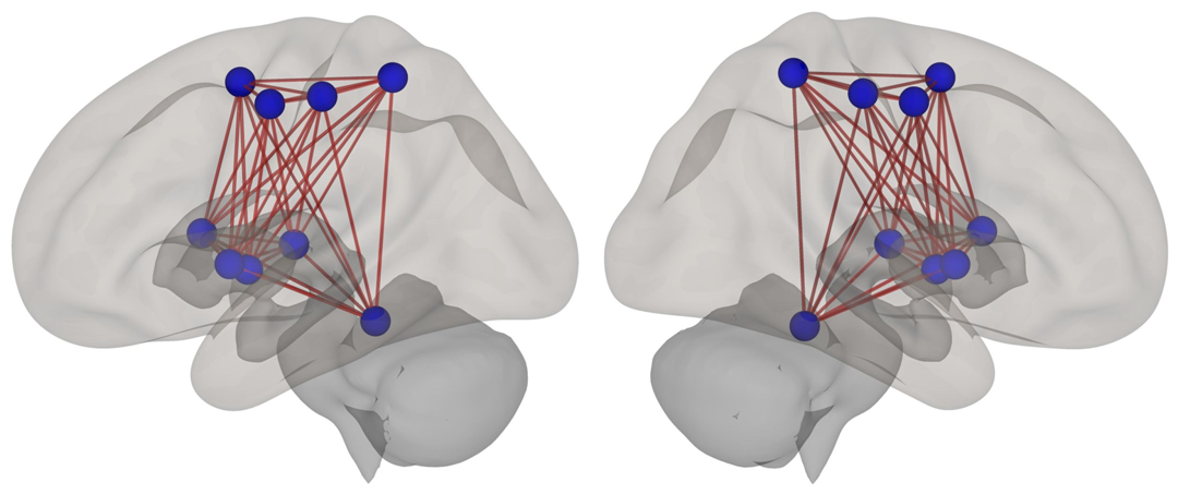 Regions of interest in the cerebral motor network