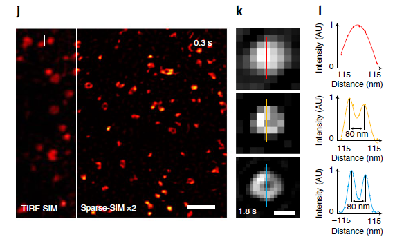 Sparse-SIM achieves ~60-nm and millisecond spatiotemporal resolution in live cells.