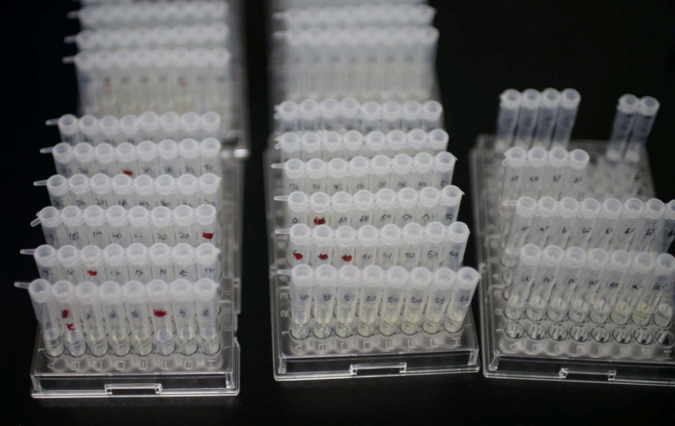 Diluted urine samples for analysis. This is only a portion of all the samples I processed.