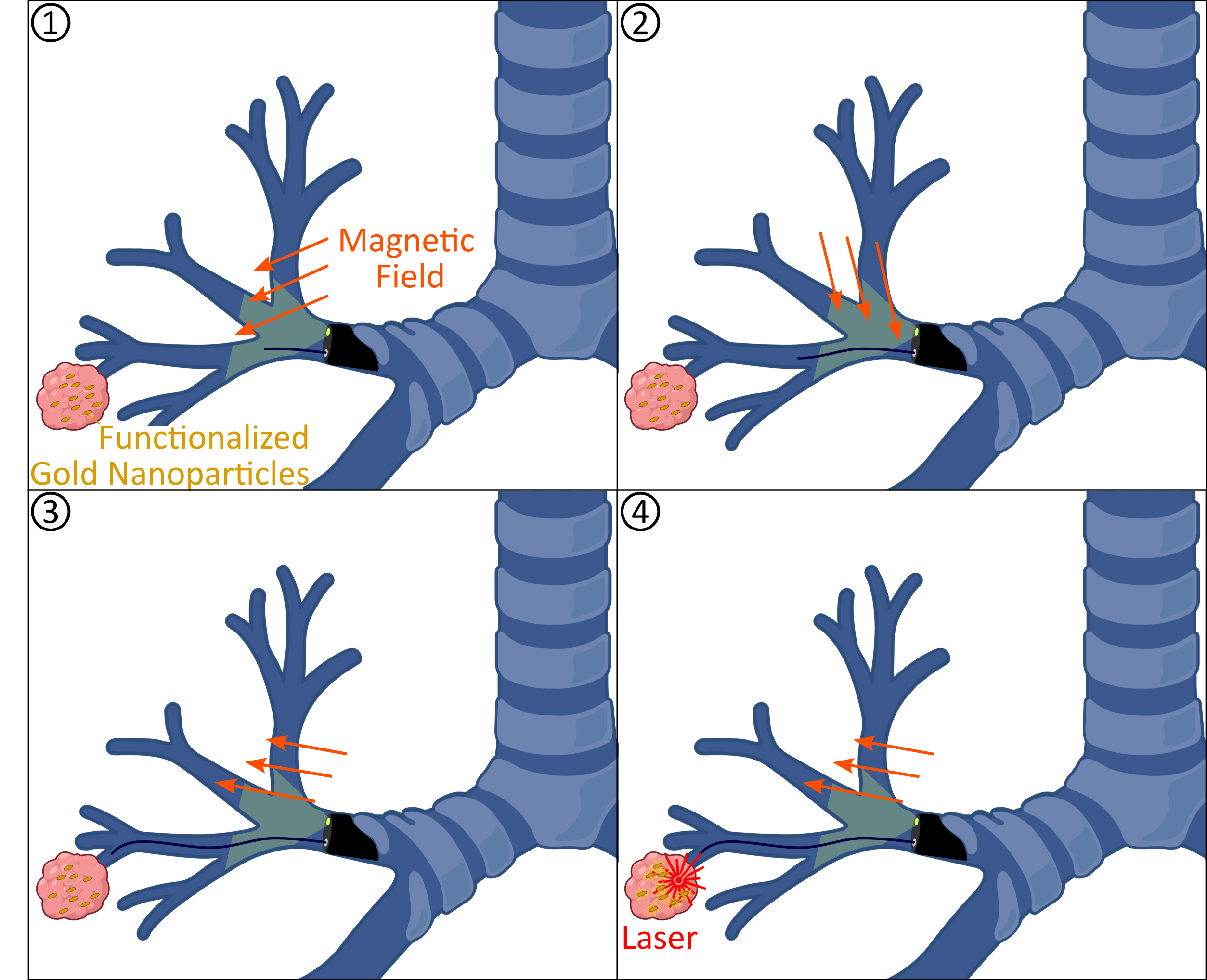 Photothermal Cancer Therapy Delivery