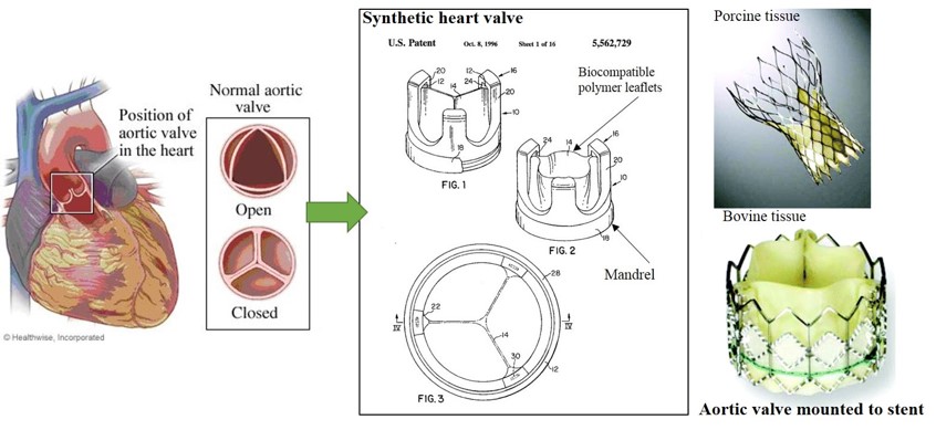 Evolution of aortic valve replacement
