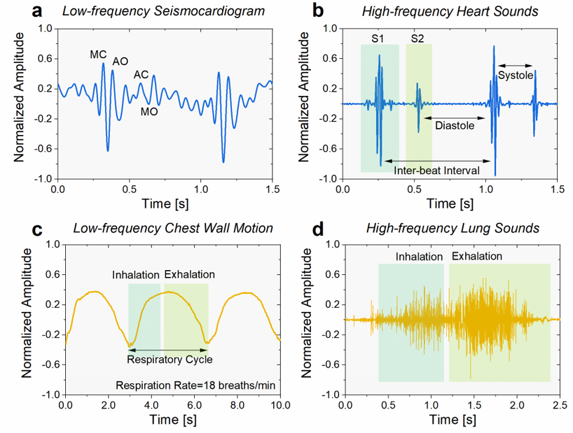 Recording cardiopulmonary vibrations Recording cardiopulmonary vibrations
